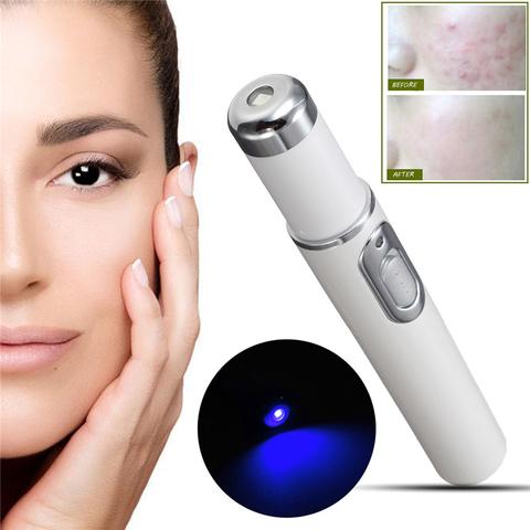 Blue Light Therapy Acne Laser Pen Soft Scar Wrinkle Removal Treatment